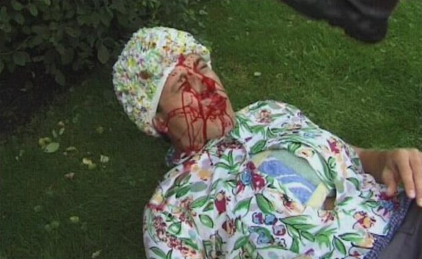 Stillbild 8 ur TUBERKULOSE